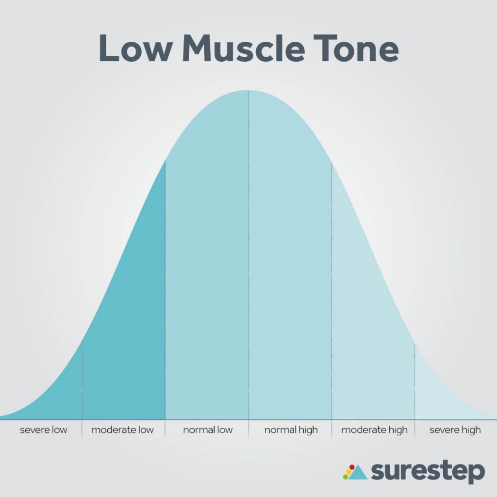 Low muscle tone spectrum