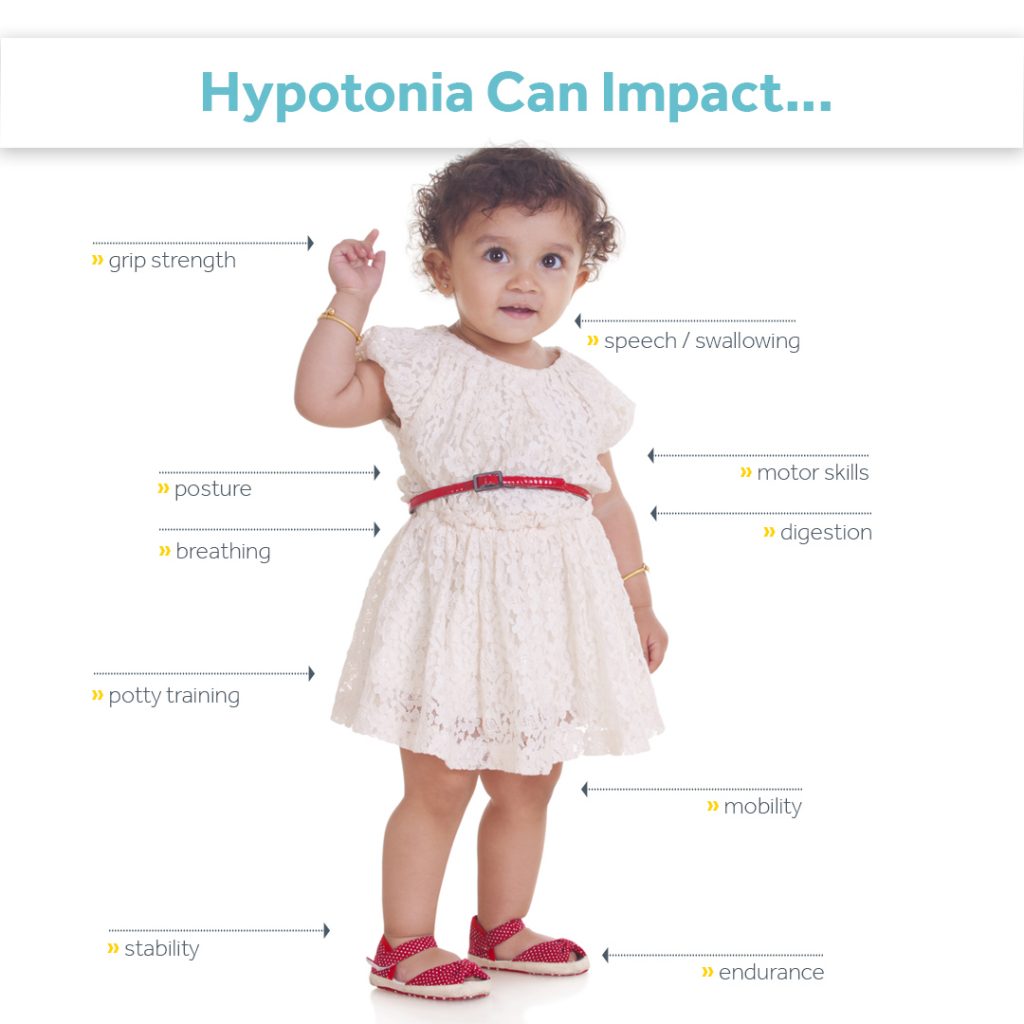 Symptoms of Hypotonia