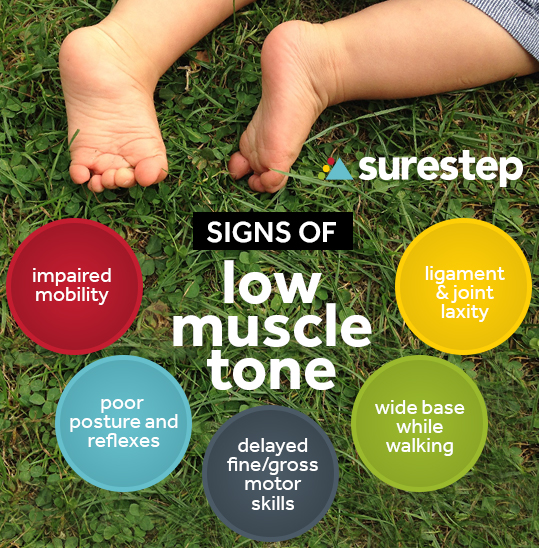 Low Muscle Tone: What Parents Need To Know