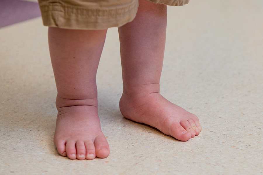 baby walking on inside of foot