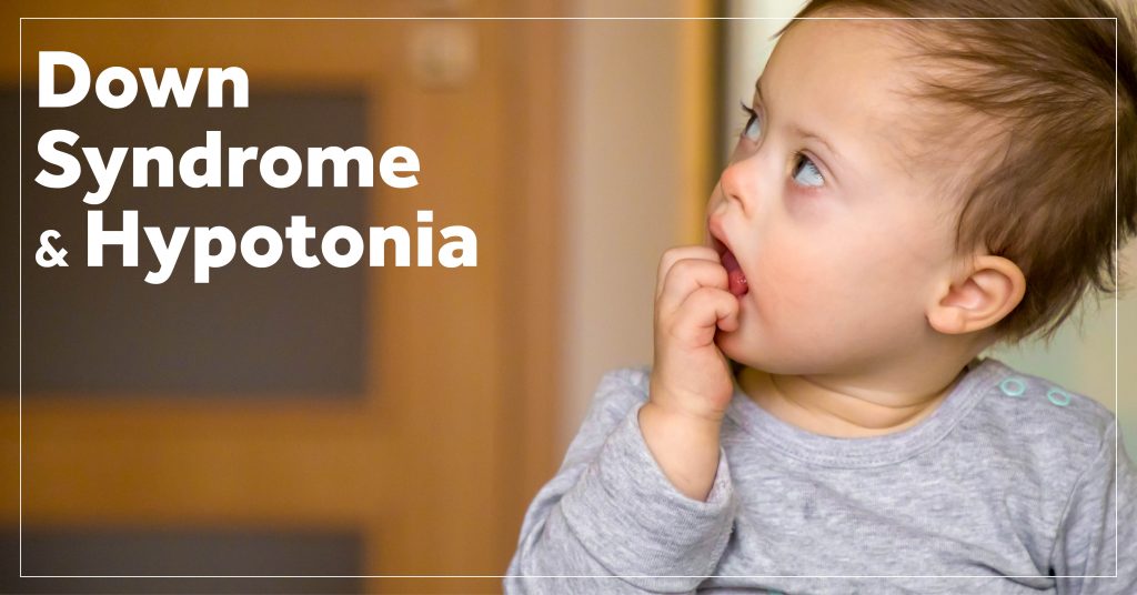 hypotonia down syndrome