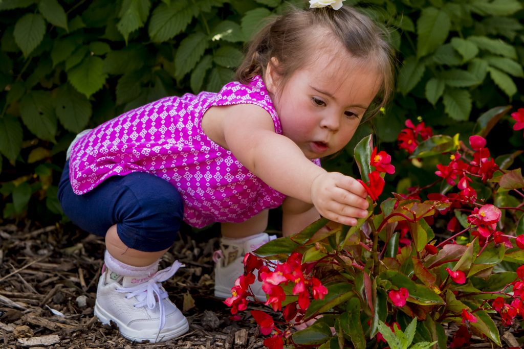 SMO orthotics for Down syndrome