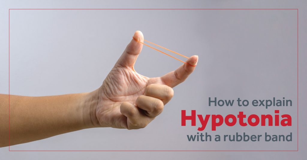 How to explain hypotonia with a rubber band