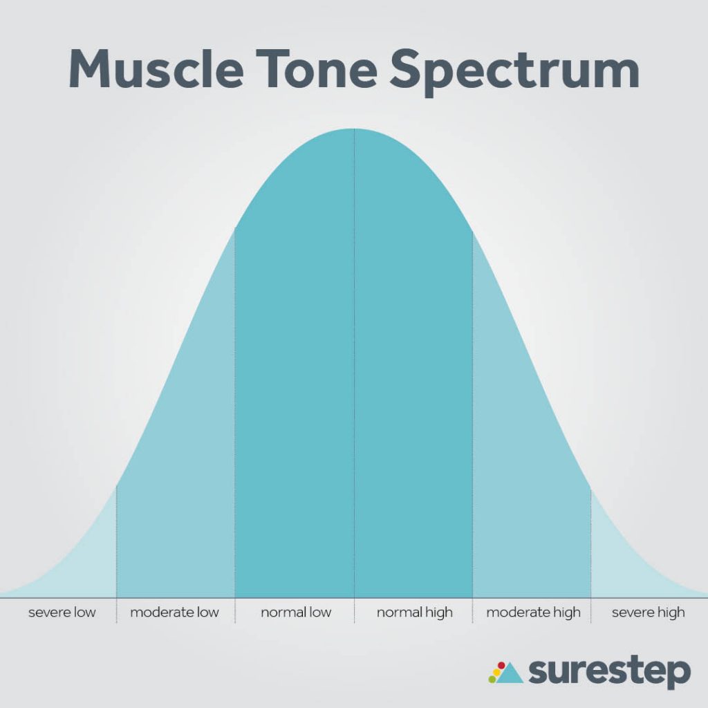 Hypertonia and hypotonia muscle tone spectrum