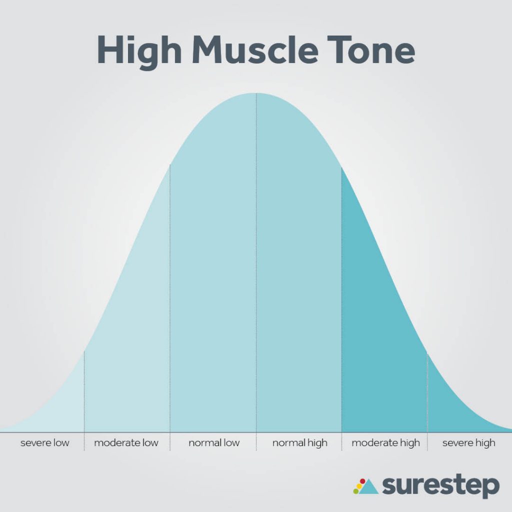 Hypertonia muscle tone bell curve