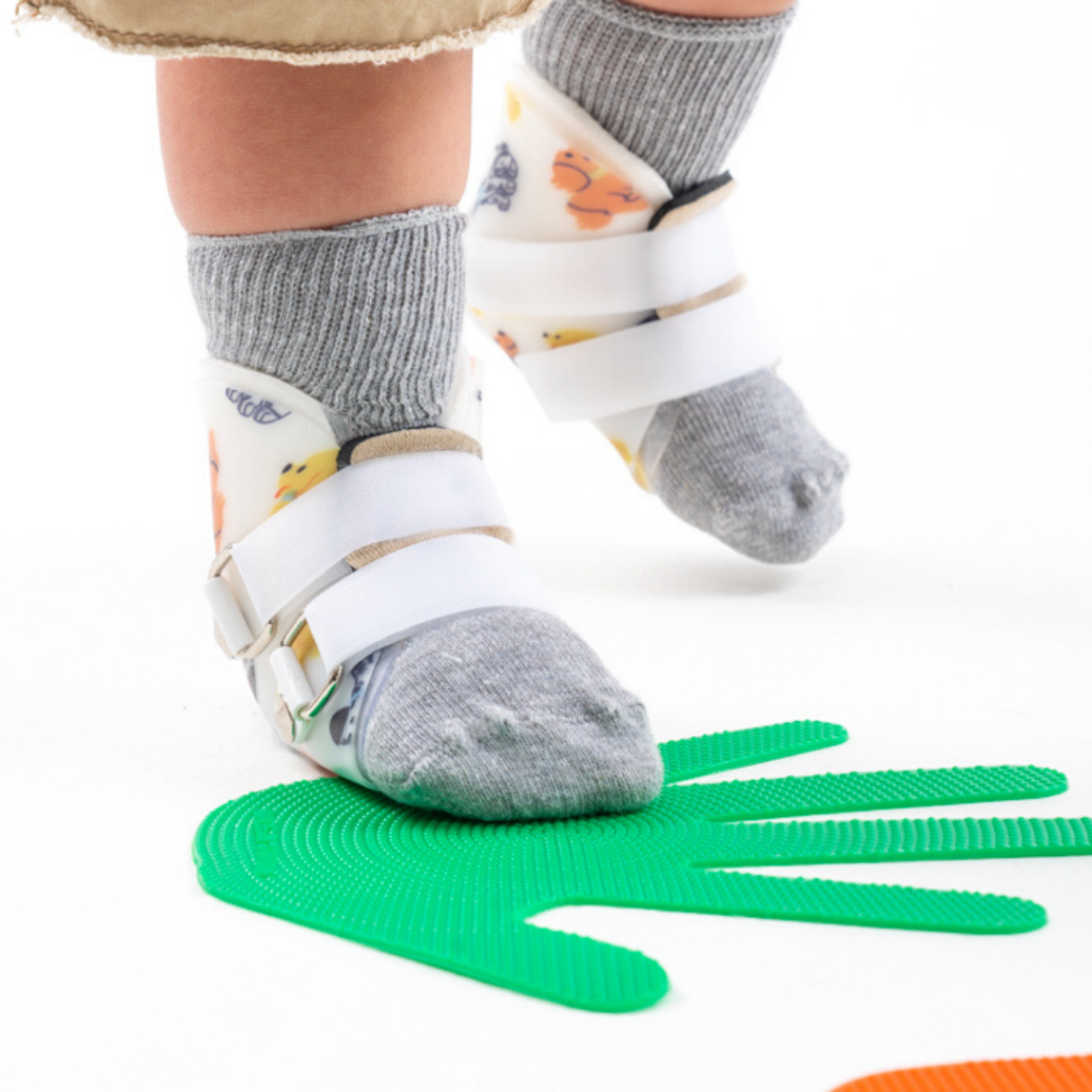 Overpronation on sale in toddlers