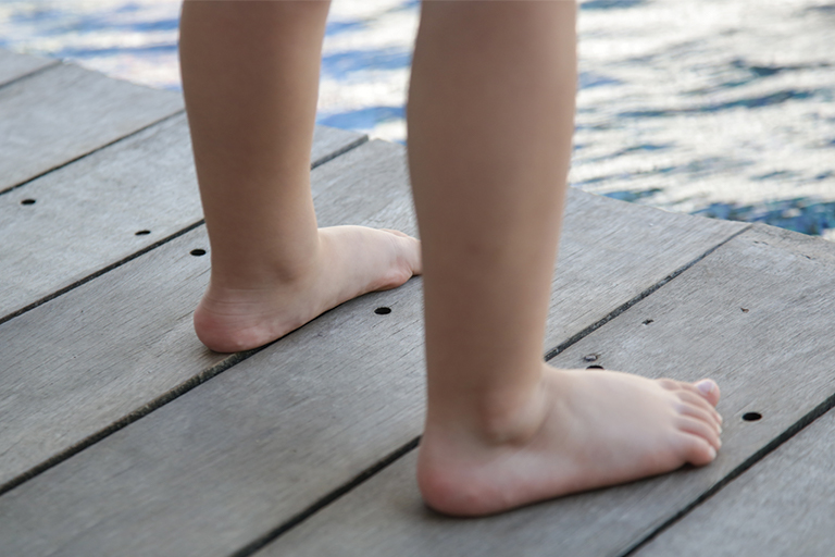 Example of pronation caused by hypotonia