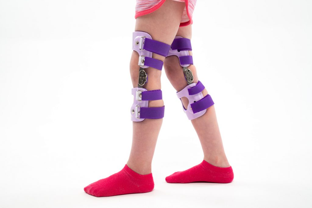 Leg Braces For Kids – How They Can Help Your Child Thrive