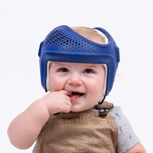 Image - Baby wearing Sprout3D Remolding Helmet