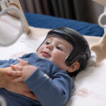 Photo - Milo in a Cranial Remolding Orthoses