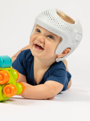 Sprout3D<sup>®</sup> Cranial Remolding Orthosis