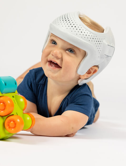 Sprout3D<sup>®</sup> Cranial Remolding Orthosis